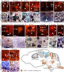 Citizenship varies depending on your situation. Frontiers Deletion Of Bdnf In Pax2 Lineage Derived Interneuron Precursors In The Hindbrain Hampers The Proportion Of Excitation Inhibition Learning And Behavior Molecular Neuroscience