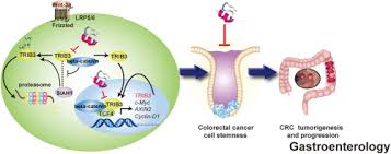Surgical resection may be curative alth. Trib3 Interacts With B Catenin And Tcf4 To Increase Stem Cell Features Of Colorectal Cancer Stem Cells And Tumorigenesis Gastroenterology