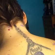 We did not find results for: Chiari Malformation