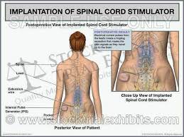 Pin On Stock Medical Illustrations