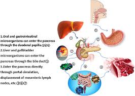 Symptoms can include feeling thirsty and hungry, and having to urinate often. Frontiers Research Progress Of Pancreas Related Microorganisms And Pancreatic Cancer Oncology