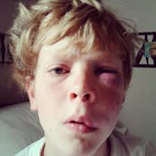 Harry Hopper (Hazzyhop36@)