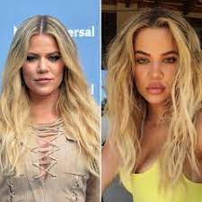 Check out full gallery with 4515 pictures of kim kardashian. Khloe Kardashian 3 Millionen Dollar Fur Neues Gesicht Und Korper Gala De