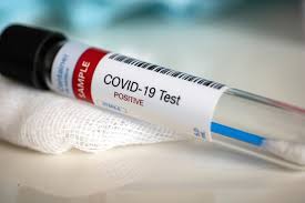 We received 48 new cases in addition to the below 25. Nine New Cases Of Covid 19 Reported In Grey Bruce Today Collingwoodtoday Ca