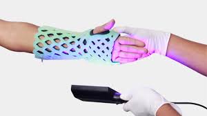 Image result for Short Arm Cast