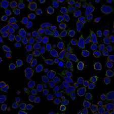 Quante proteine mangiare in funzione dell'età e dell'attività fisica. Cell Atlas Btk The Human Protein Atlas
