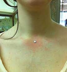 Newest Pic Dermal Piercing Clavicle Concepts Skin Piercings Are Generally Also Called Single Point Piercin In 2021 Dermal Piercing Dermal Piercing Chest Body Piercings