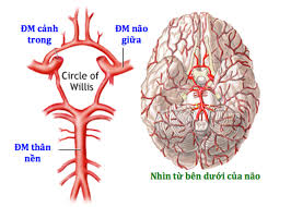 Có hai loại đột quỵ chính: Nhá»¯ng Ä'iá»u Cáº§n Biáº¿t Vá» Ä'á»™t Quá»µ Nao