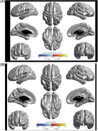 It reaches the level of the renal medulla where the thin descending limb of loop of henle borders with the thick. Https Kops Uni Konstanz De Bitstream 123456789 38173 1 Dedovic 2 7wp2dkuon3ty5 Pdf