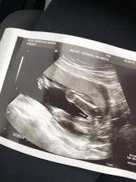 Medical research has debunked this heart rate gender prediction theory. They Didn T Tell Me My Baby Gender First Time Moms Babycenter Canada