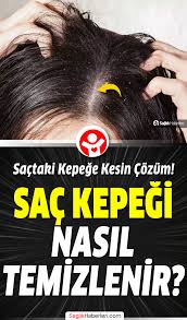 Sactaki Kepek Nasil Gecer Dogal Yontemler 2021 Sac Guzellik Sirlari Kepek