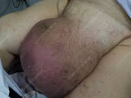 Image result for Scrotum