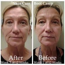 Pin On Skin Care Boot Camp Hollywood Florida