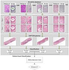 A cancerous tumor (malignant neoplasm) can grow unchecked, invade healthy tissue and metastasize (spread), or spread from the place where it starts to other . A Framework For Distinguishing Benign From Malignant Breast Histopathological Images Using Deep Residual Networks