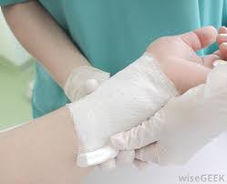 How to clean a wound in 6 steps step 1: What Are Butterfly Stitches With Pictures