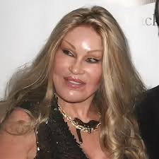 The Real Story Behind the "Lion Woman's" Face