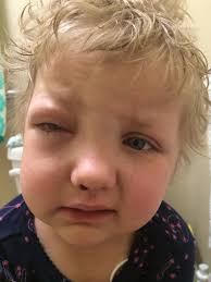 Dr. Soheil Meshinchi