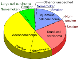 File Pie Chart Of Lung Cancers Svg Wikimedia Commons