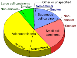 file pie chart of lung cancers svg wikimedia commons