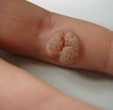 Rezultate imazhesh për korona virusas