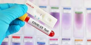 800 Alat Rapid Test Masih Tersedia Pemko Gencar Cari Otg Covid 19 Pekanbaru Go Id