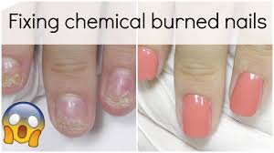Wait, i thought acrylic nails were bad for your natural nail? Extremely Damaged Nail Transformation How To Fix It With Polygel Youtube