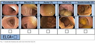 Resultat d'imatges de indicaciones colonoscopia