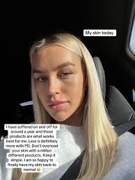 La Roche Posay Dermatitis