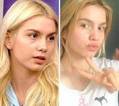 Şeyma subaşı, instagram hesabı üzerinden estetik yaptırdığını duyurdu. Estetik Operasyonlara Kucuk Yasta Basladiklarini Ogrendiginizde Dumura Ugrayacaginiz 14 Unlu Onedio Com