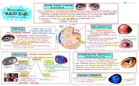Image result for Acute Red Eye