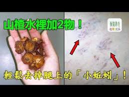 山楂水裡加2物 輕鬆解決靜脈曲張 去掉腿上的 小蚯蚓 youtube happy birthday video birthday gif make it yourself