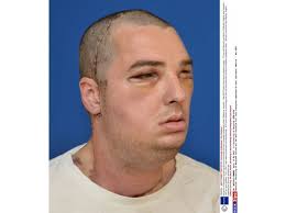 Les incroyables transformations de Richard Norris