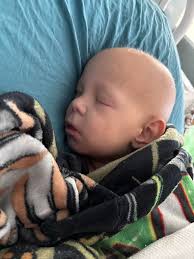 Brayden is not feeling too good today. He is retaining a lot of fluids and  causing him to be puffy. He lines is confirmed to have an infection, and  now the other