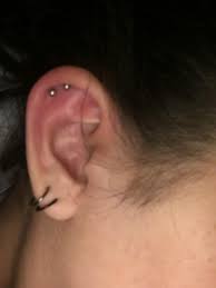 Is This Normal For A 3 Day Old Helix Piercing Please Help Piercing