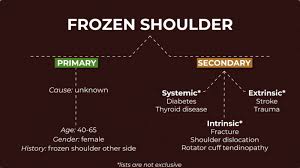 Image result for Shoulder History