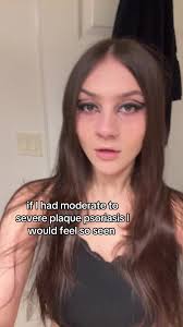 Effective Dandruff Removal Techniques for Healthy Scalps