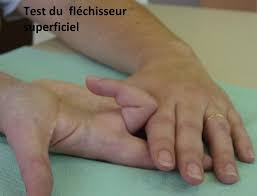 Vous bénéficiez d'un droit d'accès et de rectification de vos données personnelles, ainsi que celui d'en demander l'effacement dans les. Lesions Ou Section Des Tendons Flechisseurs De La Main Pathologies Et