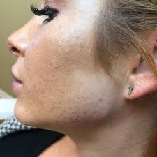 PURE Medspa and Wellness