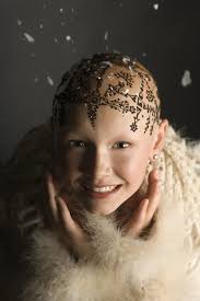 What It's Like to Live With Alopecia