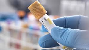 Durch eine regelmäßige medikamenteneinnahme kann die konzentration der viren so gering gehalten werden, dass die erkrankung selbst sich kaum oder gar nicht bemerkbar macht. Weltweit Zweiter Hiv Patient Gilt Als Geheilt Aktuell Welt Dw 11 03 2020