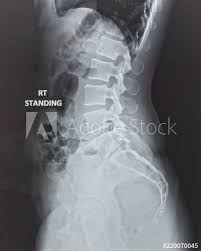 The human body is made up of several organ systems that work together as one unit. X Ray Of Human Back Spine Cord Radiography With Digital Imaging Film Display Internal Organ Of Woman Patient S Health Rib Pelvis Hip Joint Spinal Skeleton For Medical Diagnostic Analysis Stock Photo Adobe