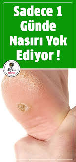 Nasir Problemini Aninda Yok Ediyor Saglik Saglik Ipuclari Dogal Saglik