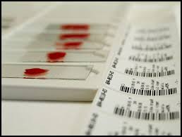 норма глюкозы в крови у женщин после 70 лет Chto Takoe Glikirovannyj Gemoglobin Chto On Oznachaet V Analize Krovi I Kakova Ego Norma