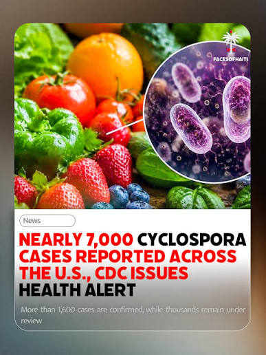 HEALTH ALERT | The CDC has issued a nationwide health advisory following a  major increase in cyclosporiasis, an intestinal illness caused by the  microscopic Cyclospora parasite. Since May 1, health officials have