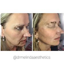 Dr Melinda Aesthetics