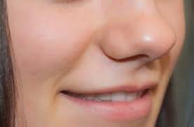 This procedure typically costs between $1000 and $3000 without insurance. How To Fix Loose Tooth At Home Diy Tooth