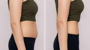 Carboxiterapia na barriga antes e depois: saiba tudo sobre!