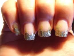 Hier kann es auch sehr sinnvoll sein, professionelle hilfe in anspruch zu nehmen. Nach Oben Wachsende Nagel Kurzes Nagelbett