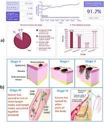 Tobacco smoking is a risk factor for several cancers. Skin Cancer Detection Using Non Invasive Techniques Rsc Advances Rsc Publishing Doi 10 1039 C8ra04164d