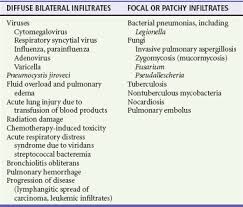 Image result for Overwhelming Postsplenectomy Infection